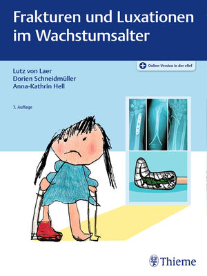 cover image of Frakturen und Luxationen im Wachstumsalter